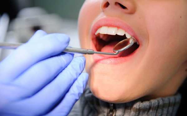 Πρόγραμμα προληπτικής οδοντιατρικής Dentist Pass: Ποια ΑΦΜ κάνουν αίτηση σήμερα